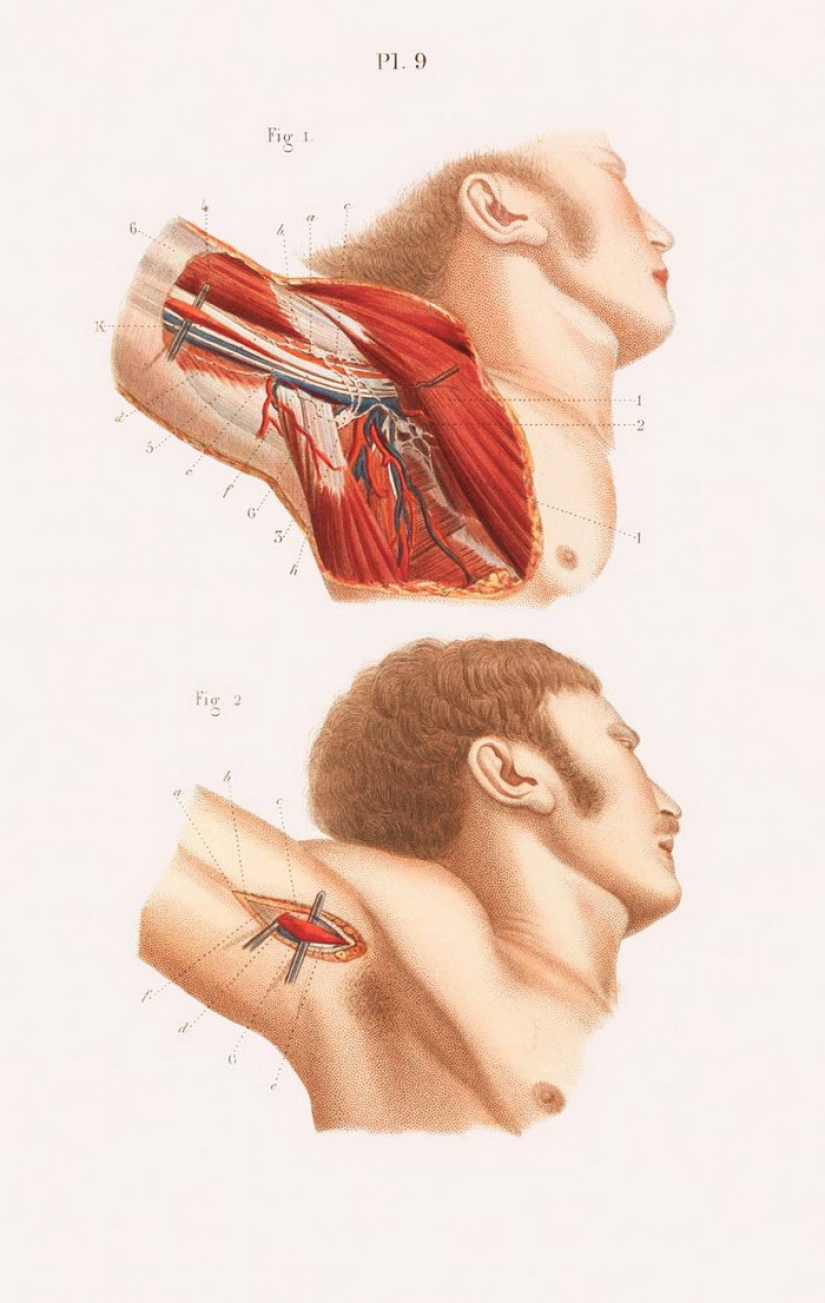 How were surgeries done at the beginning of the last century