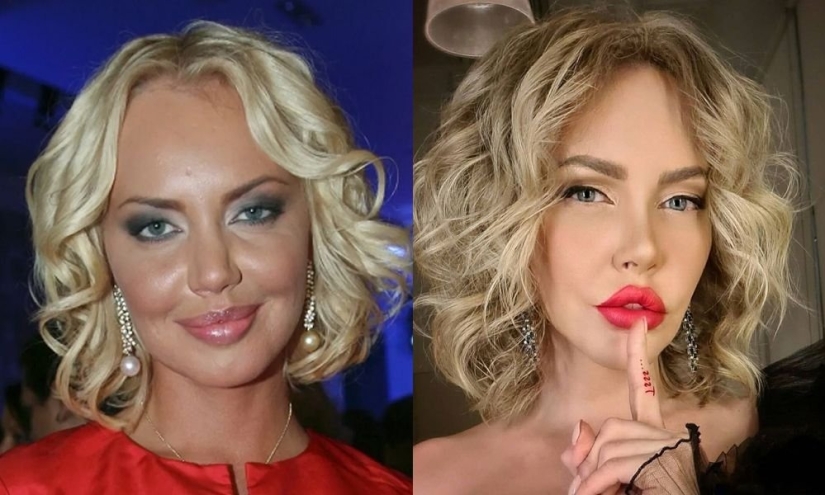 Imperfect: 10 celebrities who have something to hide