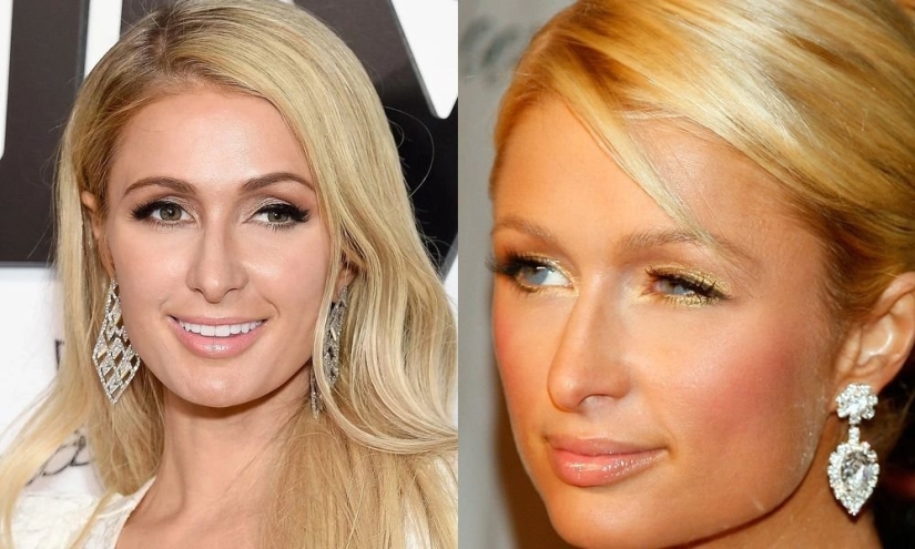 Imperfect: 10 celebrities who have something to hide