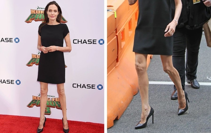 Imperfect from head to toe: 11 beauties in which at least one flaw is hidden