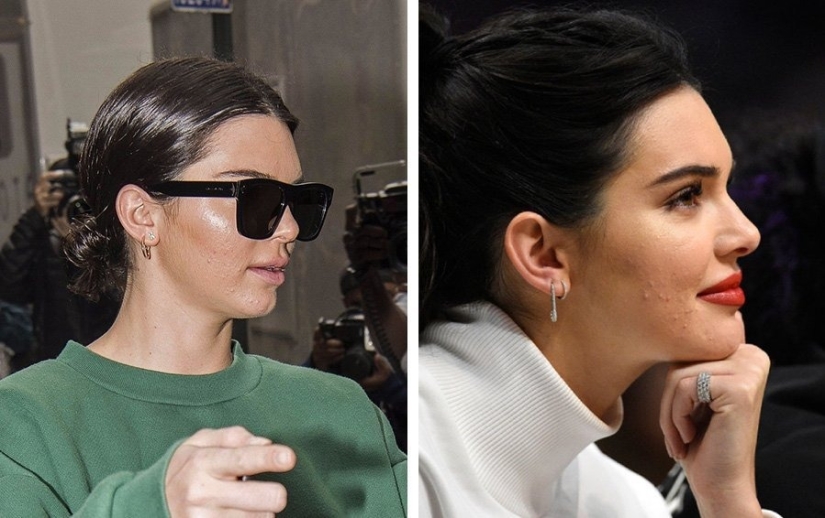 Imperfect from head to toe: 11 beauties in which at least one flaw is hidden