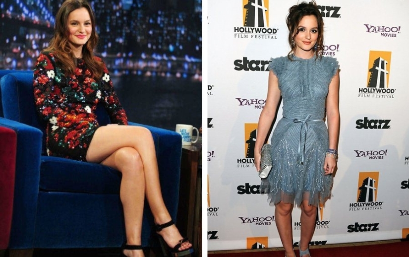 Imperfecto de pies a cabeza: 11 bellezas en las que se esconde al menos un defecto Imperfecto de pies a cabeza: 11 bellezas en las que se esconde al menos un defecto