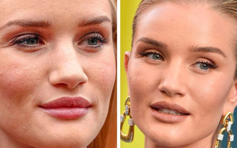 Imperfecto de pies a cabeza: 11 bellezas en las que se esconde al menos un defecto Imperfecto de pies a cabeza: 11 bellezas en las que se esconde al menos un defecto