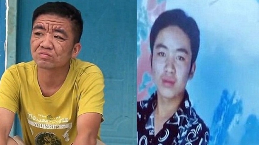 In 10 years, a Chinese youth turned into an old man