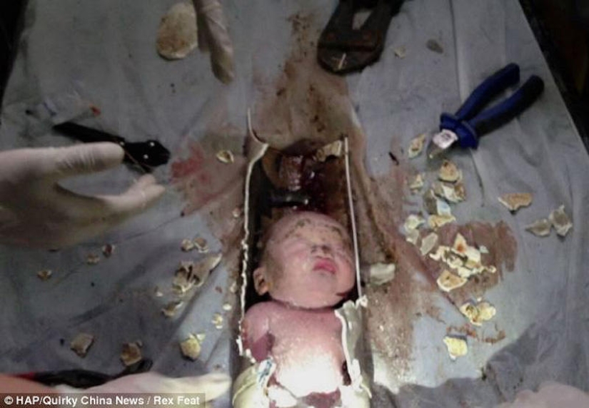 In China, a newborn was rescued after being flushed down the toilet In China, a newborn was rescued after being flushed down the toilet