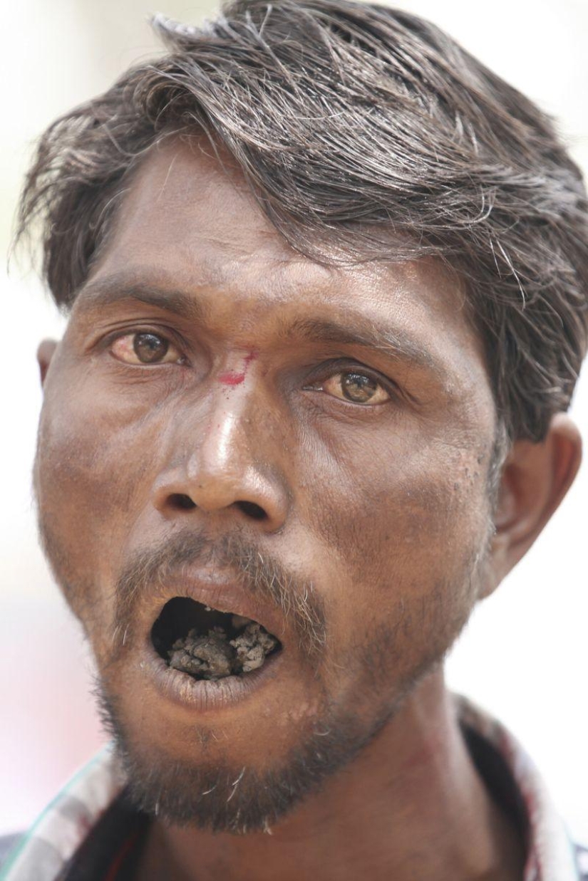 Indian man eats bricks and stones for 20 years Indian man eats bricks and stones for 20 years