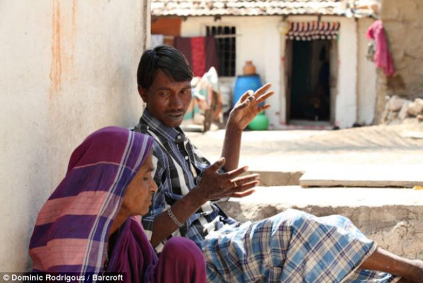 Indian man eats bricks and stones for 20 years Indian man eats bricks and stones for 20 years