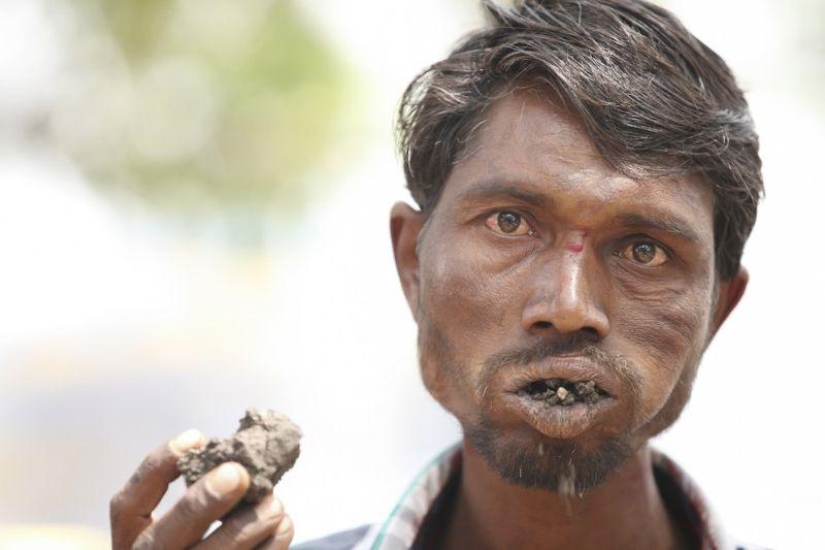 Indian man eats bricks and stones for 20 years Indian man eats bricks and stones for 20 years
