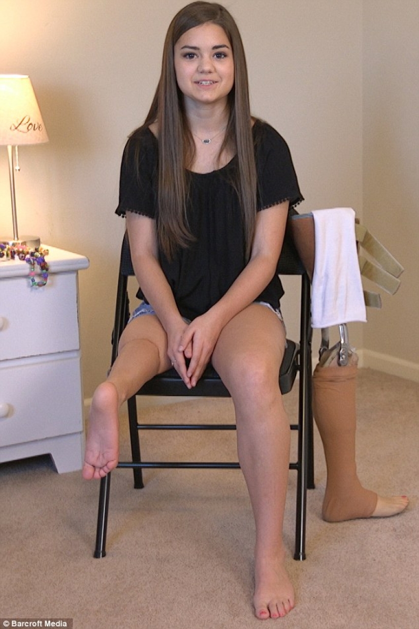 Inspiring example: a girl with a prosthetic leg became a wonderful dancer