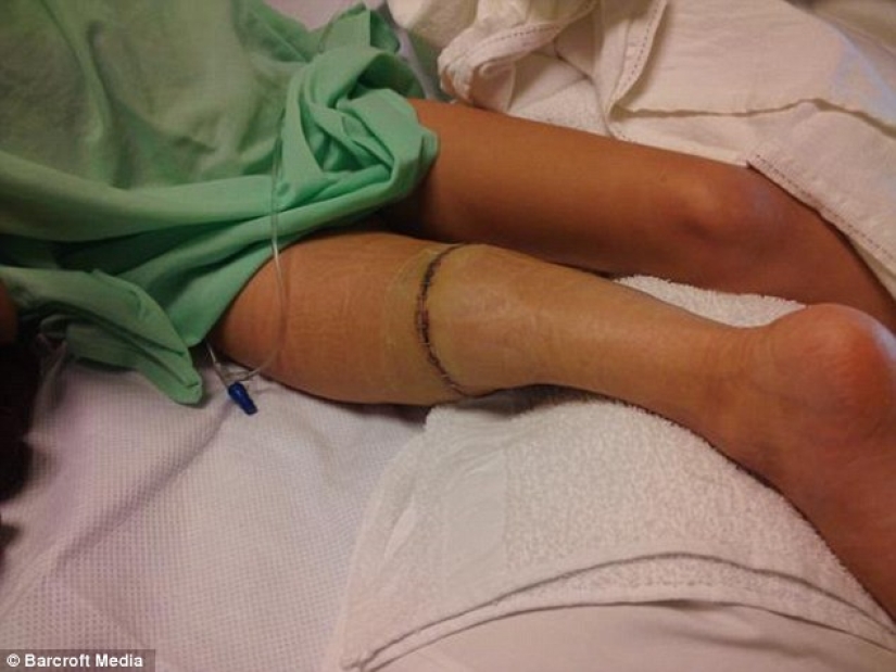 Inspiring example: a girl with a prosthetic leg became a wonderful dancer