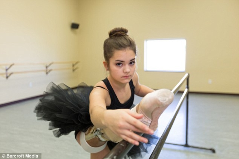 Inspiring example: a girl with a prosthetic leg became a wonderful dancer