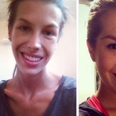 Instagram of the week: Victory over anorexia