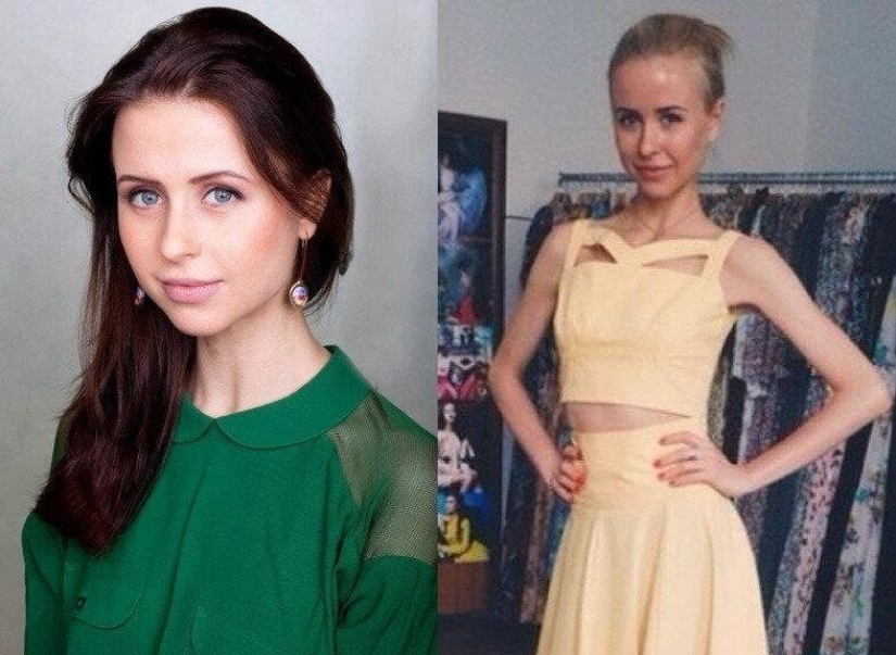 It would be better not to lose weight: the stars whose figure was harmed by diets