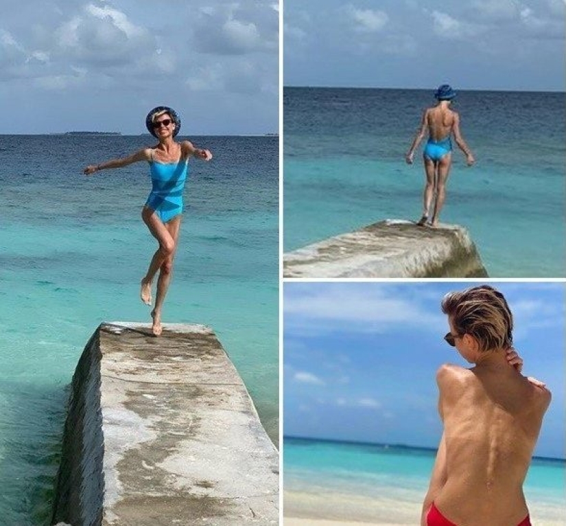 It would be better not to lose weight: the stars whose figure was harmed by diets