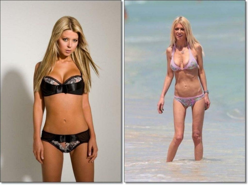 It would be better not to lose weight: the stars whose figure was harmed by diets