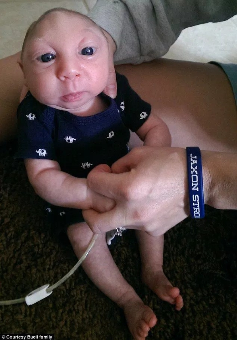 La asombrosa historia de Baby Jackson, el niño que sobrevivió La asombrosa historia de Baby Jackson, el niño que sobrevivió