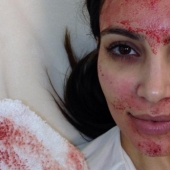 La belleza requiere sacrificio: qué hacen las estrellas en busca de la eterna juventud