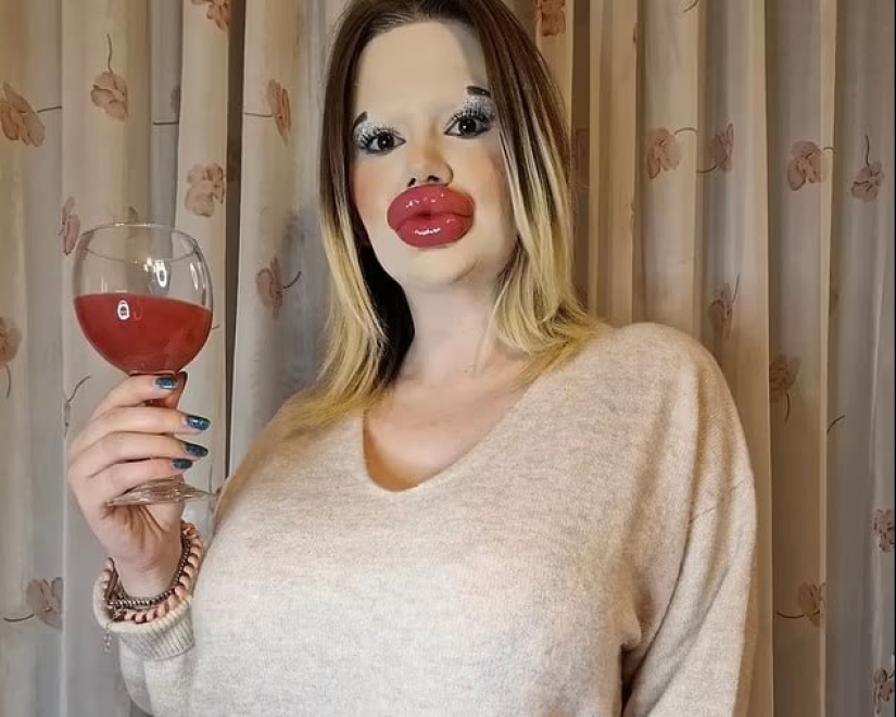 La chica con los labios más grandes del mundo decidió agrandar sus pómulos La chica con los labios más grandes del mundo decidió agrandar sus pómulos