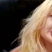 La chica con los labios más grandes del mundo decidió agrandar sus pómulos