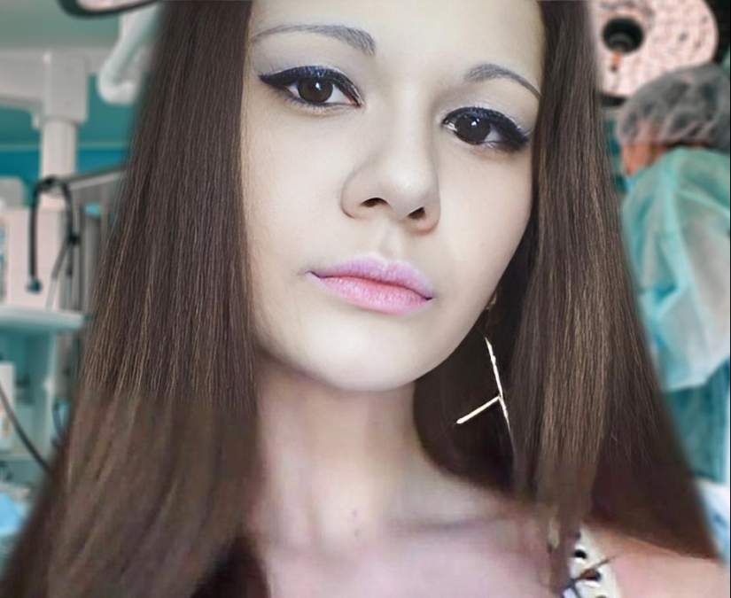 La chica con los labios más grandes del mundo decidió agrandar sus pómulos La chica con los labios más grandes del mundo decidió agrandar sus pómulos