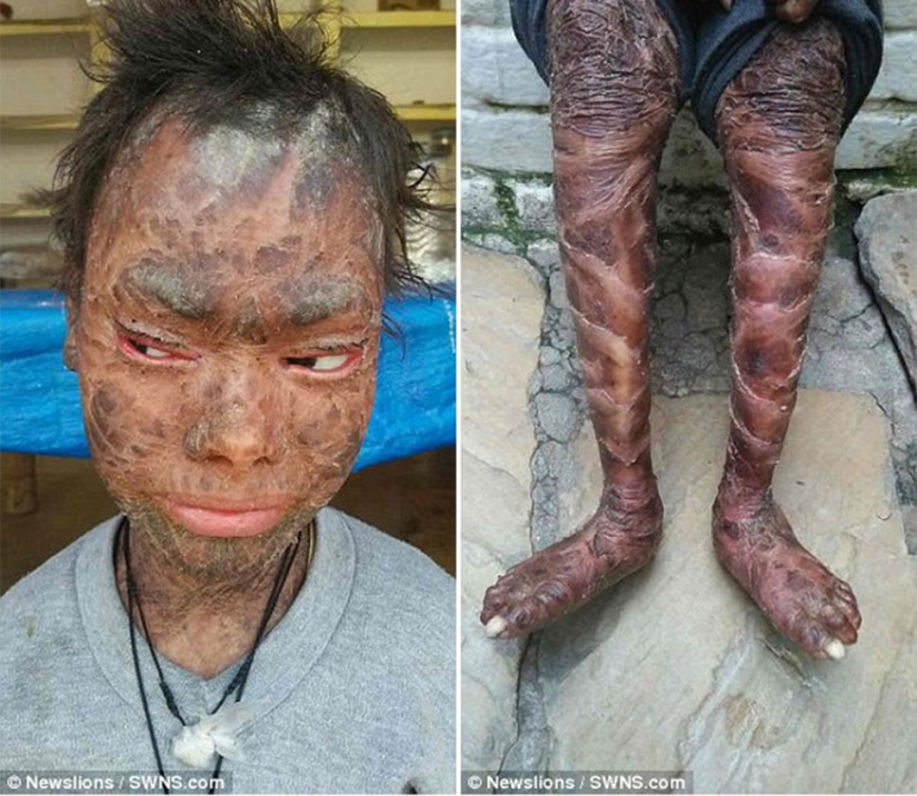 La chica serpiente se quita la piel cada seis semanas