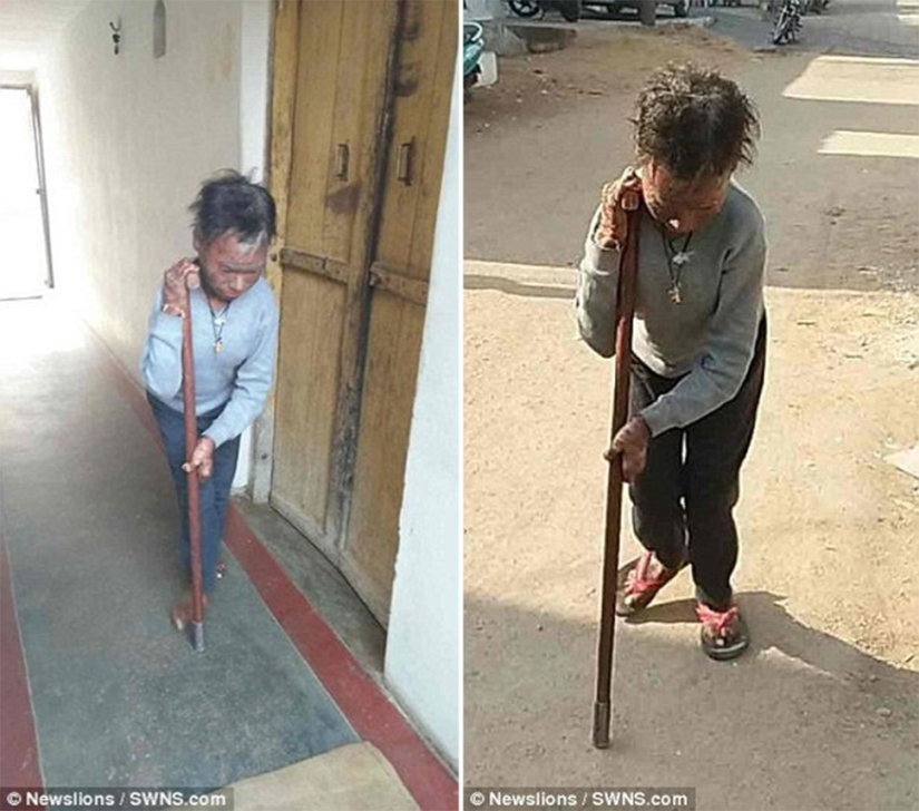 La chica serpiente se quita la piel cada seis semanas