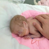 La conmovedora historia de un bebé