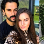 La esposa de Burak Ozchivit realizó más de 14 operaciones: ¿cómo se veía antes de la estética?