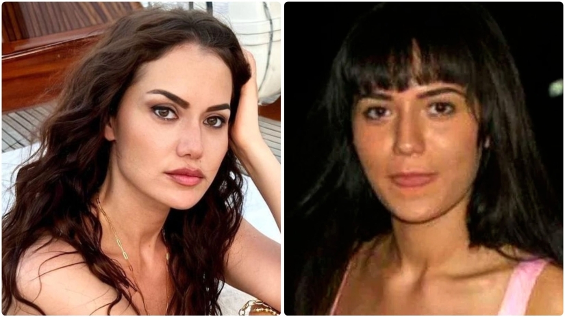 La esposa de Burak Ozchivit realizó más de 14 operaciones: ¿cómo se veía antes de la estética?