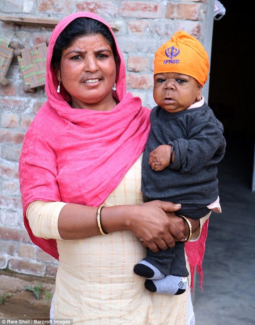 La inexplicable historia de un indio de 21 años que se quedó atrapado en el cuerpo de un bebé La inexplicable historia de un indio de 21 años que se quedó atrapado en el cuerpo de un bebé