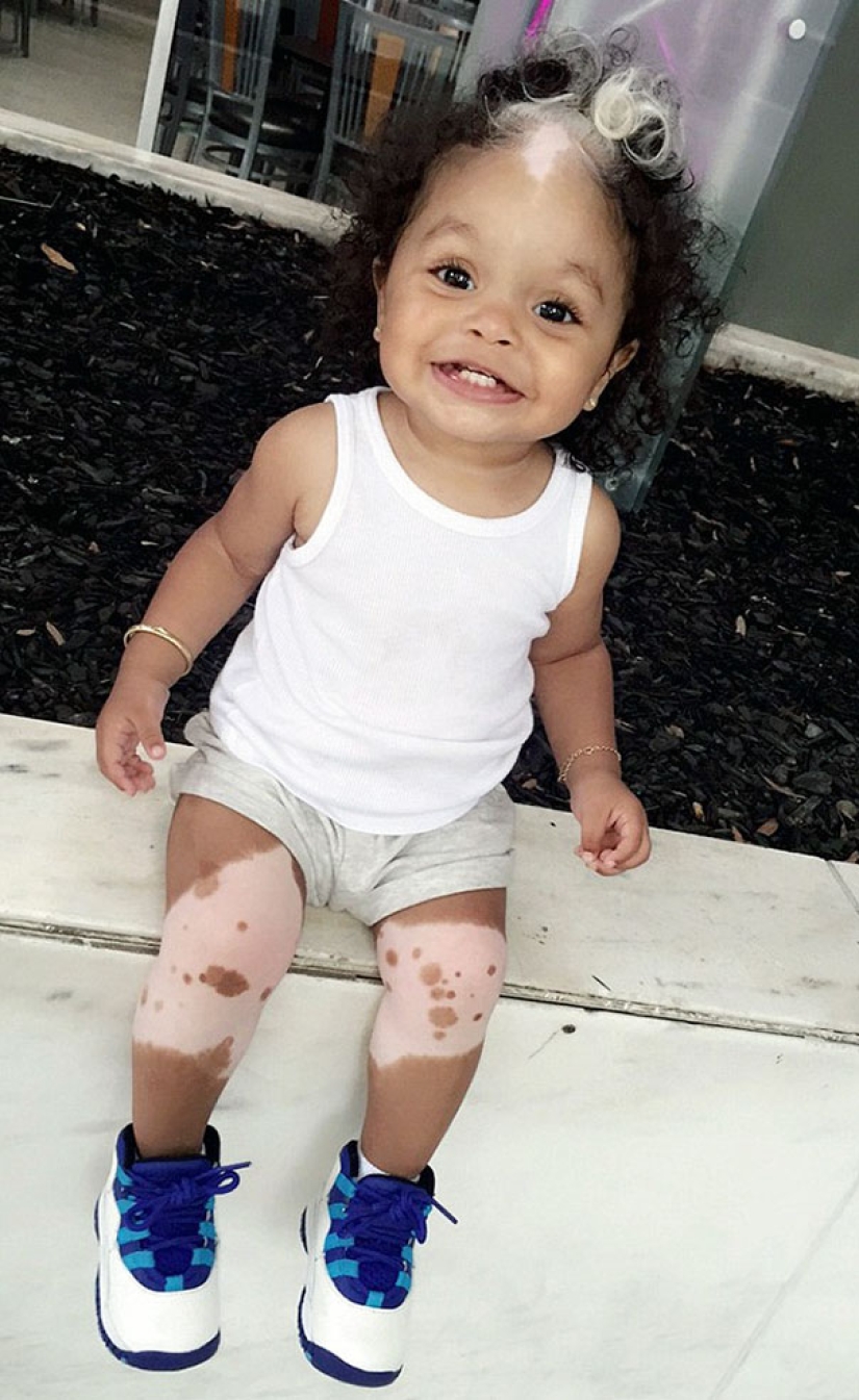 La niña nació con flequillo blanco, exactamente igual que su madre, abuela y bisabuela