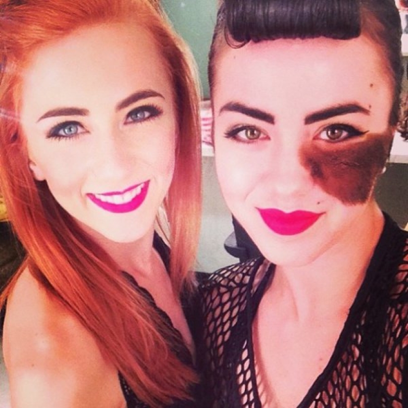 La niña se niega a quitarse la marca de nacimiento, considerándola su punto culminante. La niña se niega a quitarse la marca de nacimiento, considerándola su punto culminante.