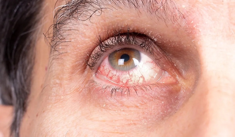 La población mundial por color de ojos