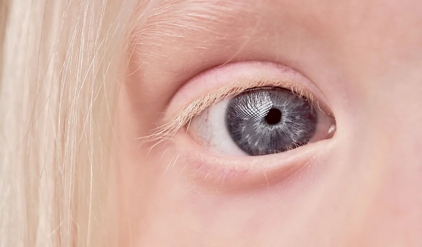 La población mundial por color de ojos
