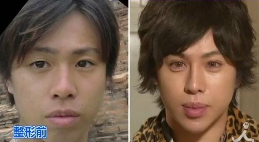 Las 7 personas más imprudentes con Plastic Surgery Mania