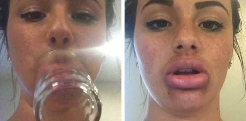 Las chicas tratan de hacer que sus labios se llenen como una estrella de televisión. no sale muy... Las chicas tratan de hacer que sus labios se llenen como una estrella de televisión. no sale muy...