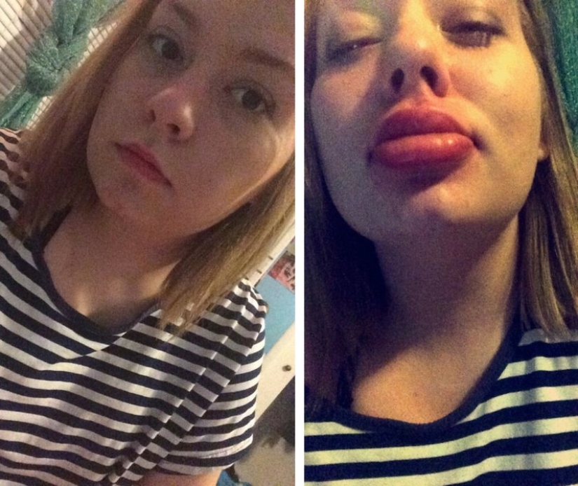 Las chicas tratan de hacer que sus labios se llenen como una estrella de televisión. no sale muy... Las chicas tratan de hacer que sus labios se llenen como una estrella de televisión. no sale muy...