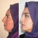 Las fotos de antes y después de la clínica turca de cirugía plástica han dejado a la gente desconcertada Las fotos de antes y después de la clínica turca de cirugía plástica han dejado a la gente desconcertada