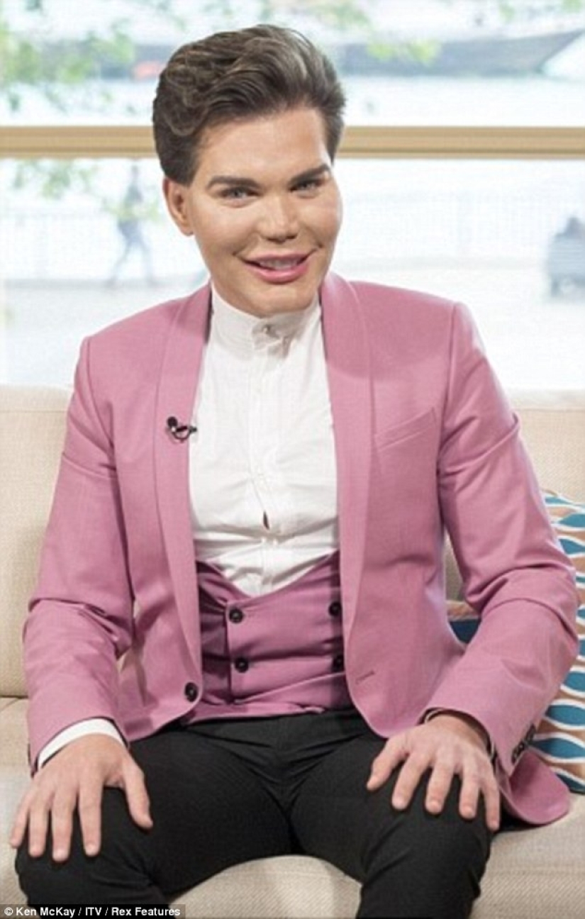 Live Ken stopped with plastic surgery when he almost lost his nose after 43 operations Live Ken stopped with plastic surgery when he almost lost his nose after 43 operations