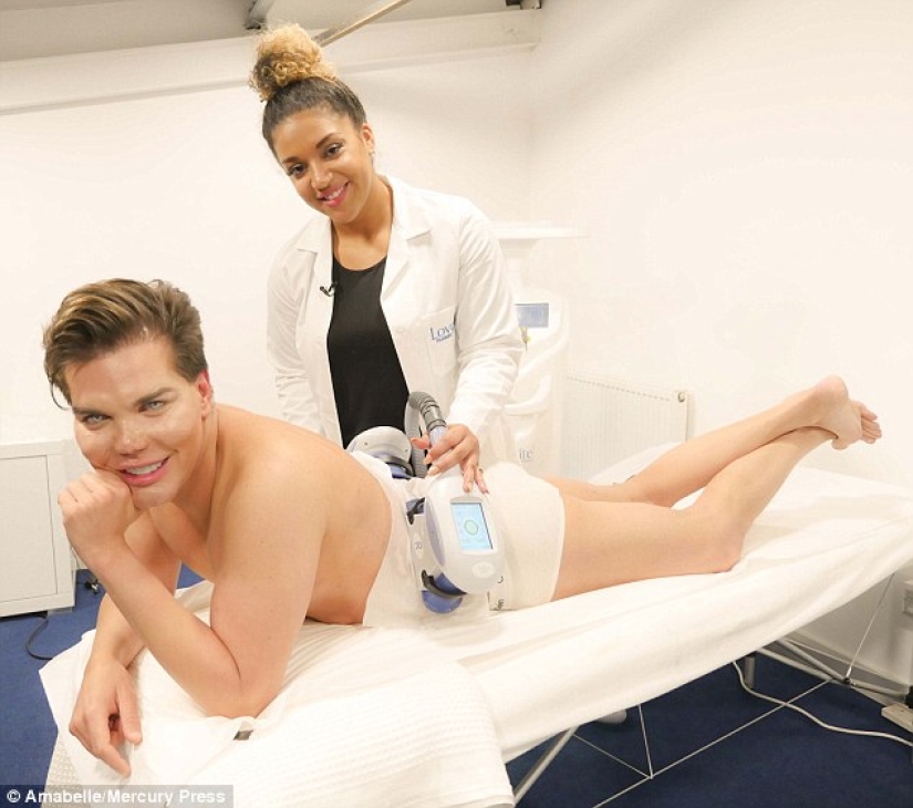 Live Ken stopped with plastic surgery when he almost lost his nose after 43 operations Live Ken stopped with plastic surgery when he almost lost his nose after 43 operations