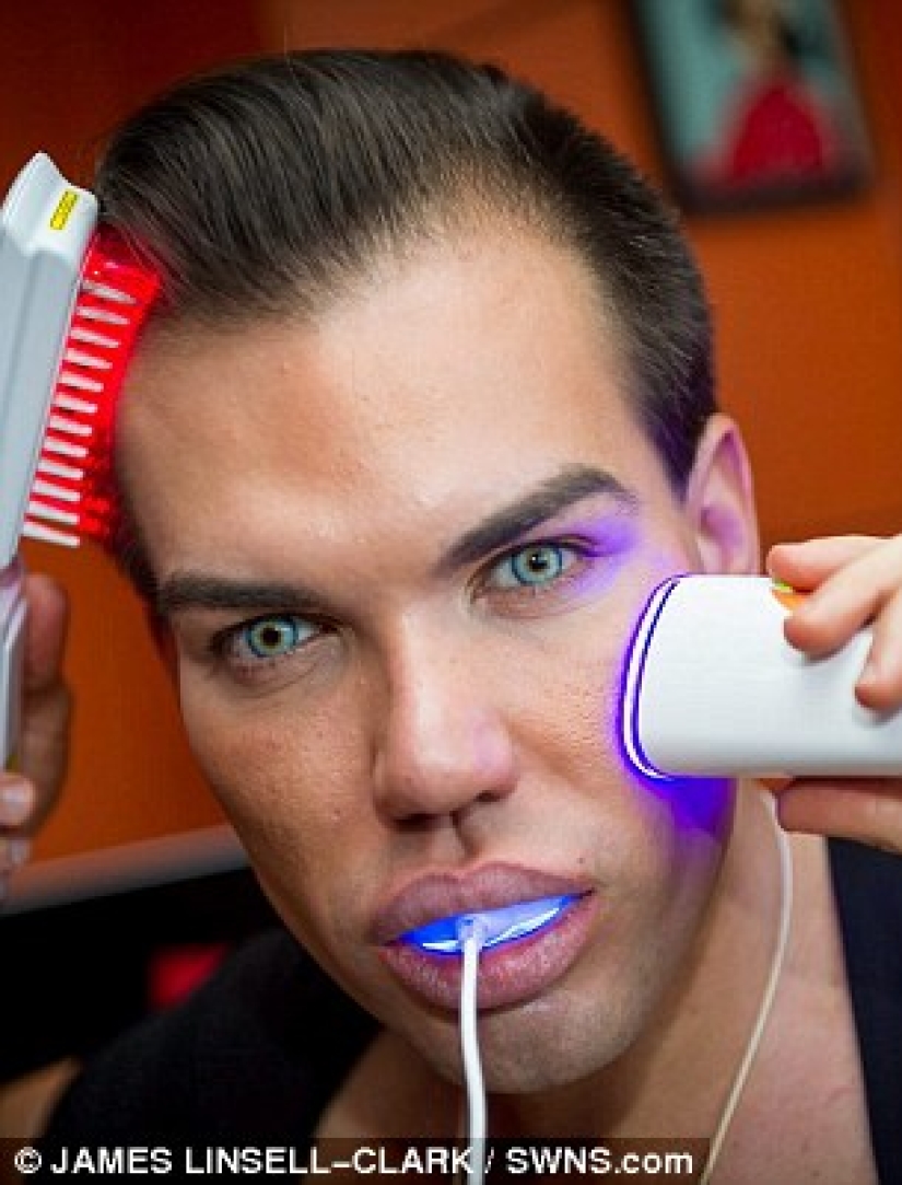 Live Ken stopped with plastic surgery when he almost lost his nose after 43 operations Live Ken stopped with plastic surgery when he almost lost his nose after 43 operations