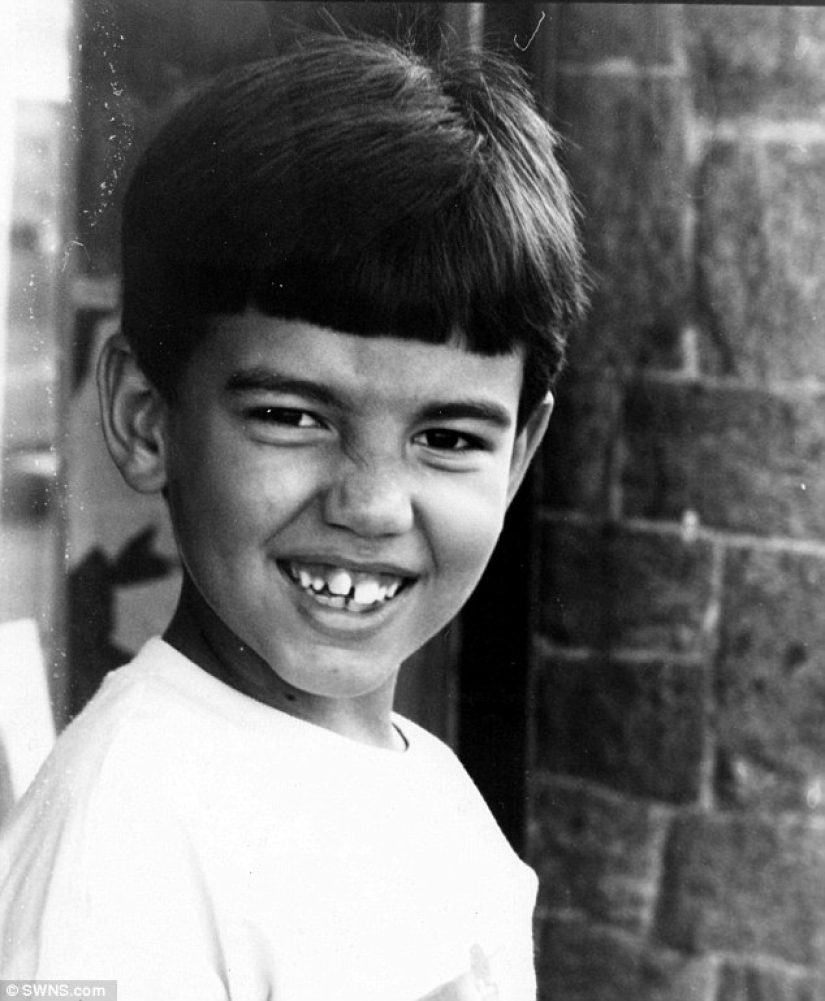 Live Ken stopped with plastic surgery when he almost lost his nose after 43 operations Live Ken stopped with plastic surgery when he almost lost his nose after 43 operations