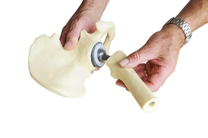 Los 10 registros médicos más increíbles