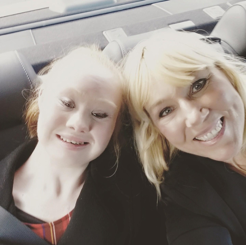 Model with Down syndrome: &quot;We can be beautiful and sexy&quot;