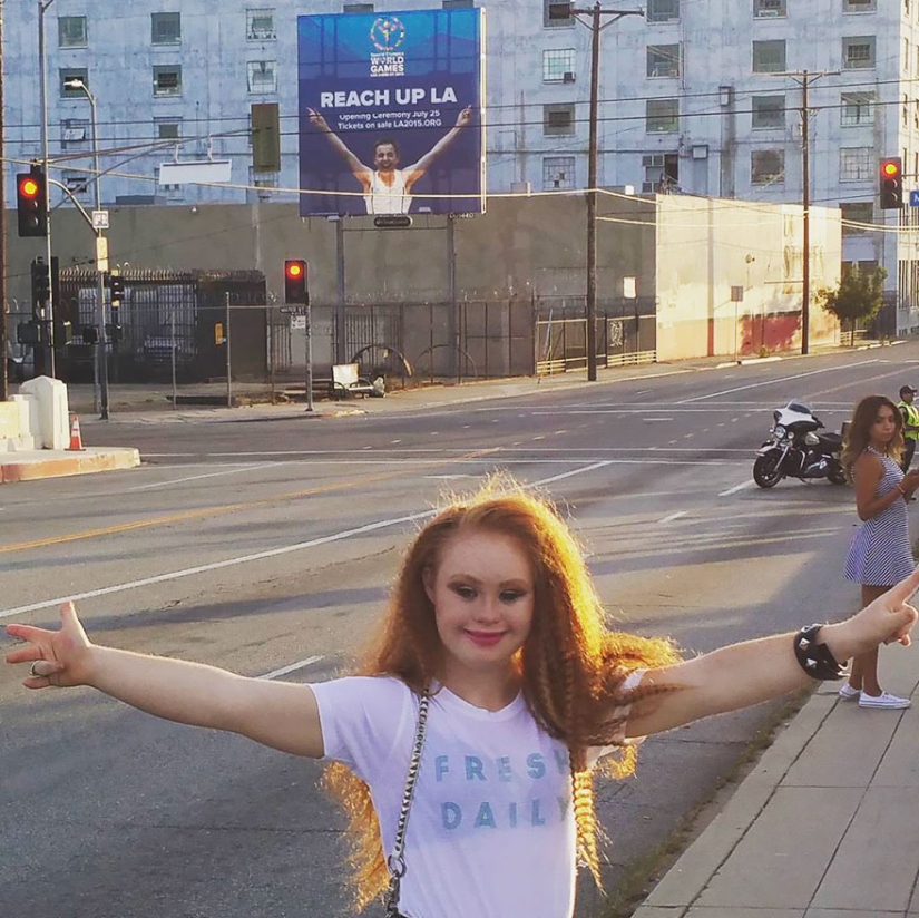 Model with Down syndrome: &quot;We can be beautiful and sexy&quot;