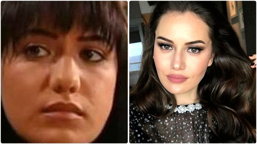 More than 14 operations were performed by the wife of Burak Ozchivit - what did she look like before aesthetics?