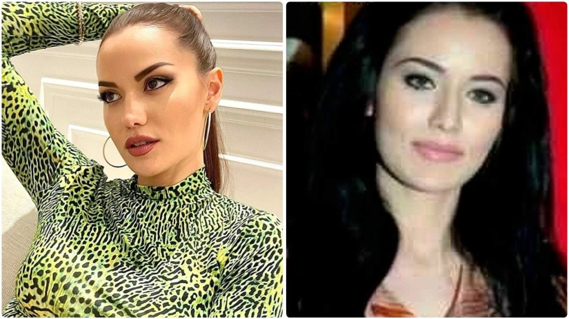 More than 14 operations were performed by the wife of Burak Ozchivit - what did she look like before aesthetics?