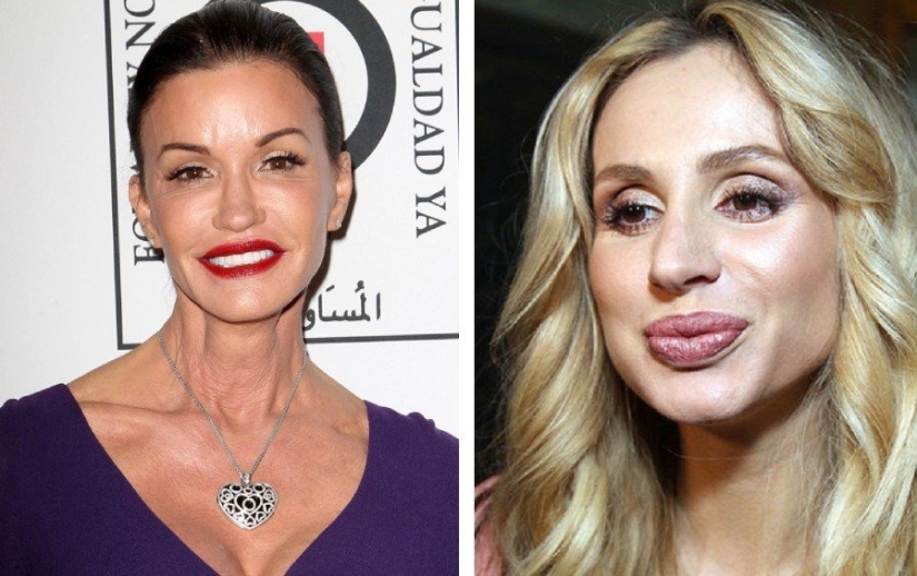 No vayas a la esteticista: 9 procedimientos de belleza más peligrosos e inútiles