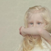 Not like everyone else: albino people