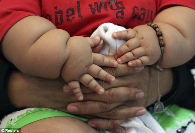 Obese 8-month-old baby seized from parents Obese 8-month-old baby seized from parents